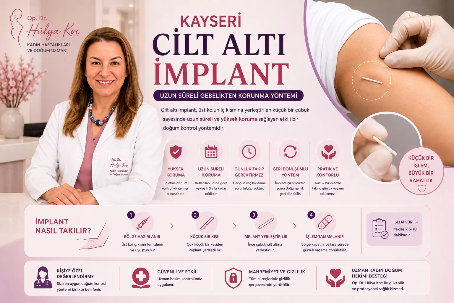 Kayseri Cilt Altı İmplant Uygulaması ile Uzun Süreli Gebelikten Korunma
